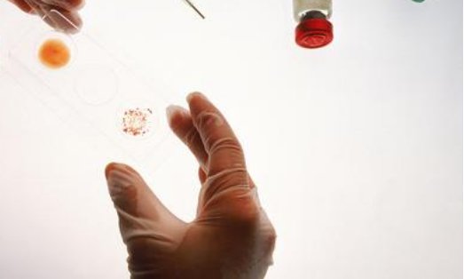 艾滋病窗口期多长时间,艾滋病过了窗口期会有啥症状?