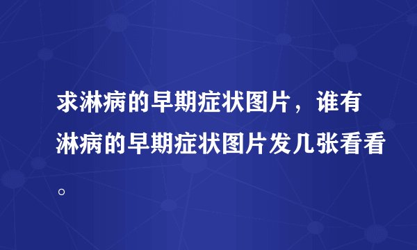 求淋病的早期症状图片，谁有淋病的早期症状图片发几张看看。