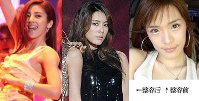 请问有没有朴嘉熙整容的对比照片啊