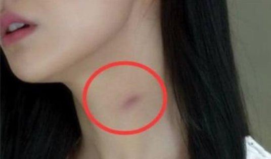 我网络语言中“种草莓”是什么意思？？？