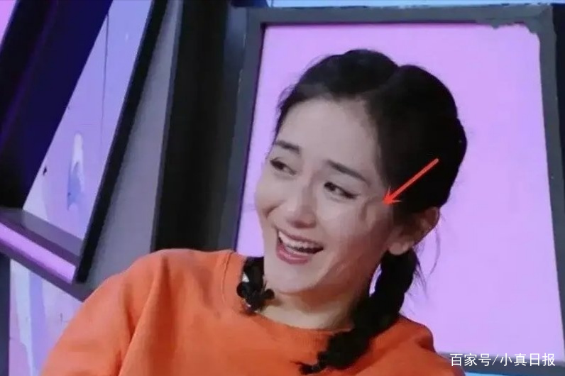 谢娜整容终于被扒，眼角大坑超明显，为什么总有人不相信她会整容？