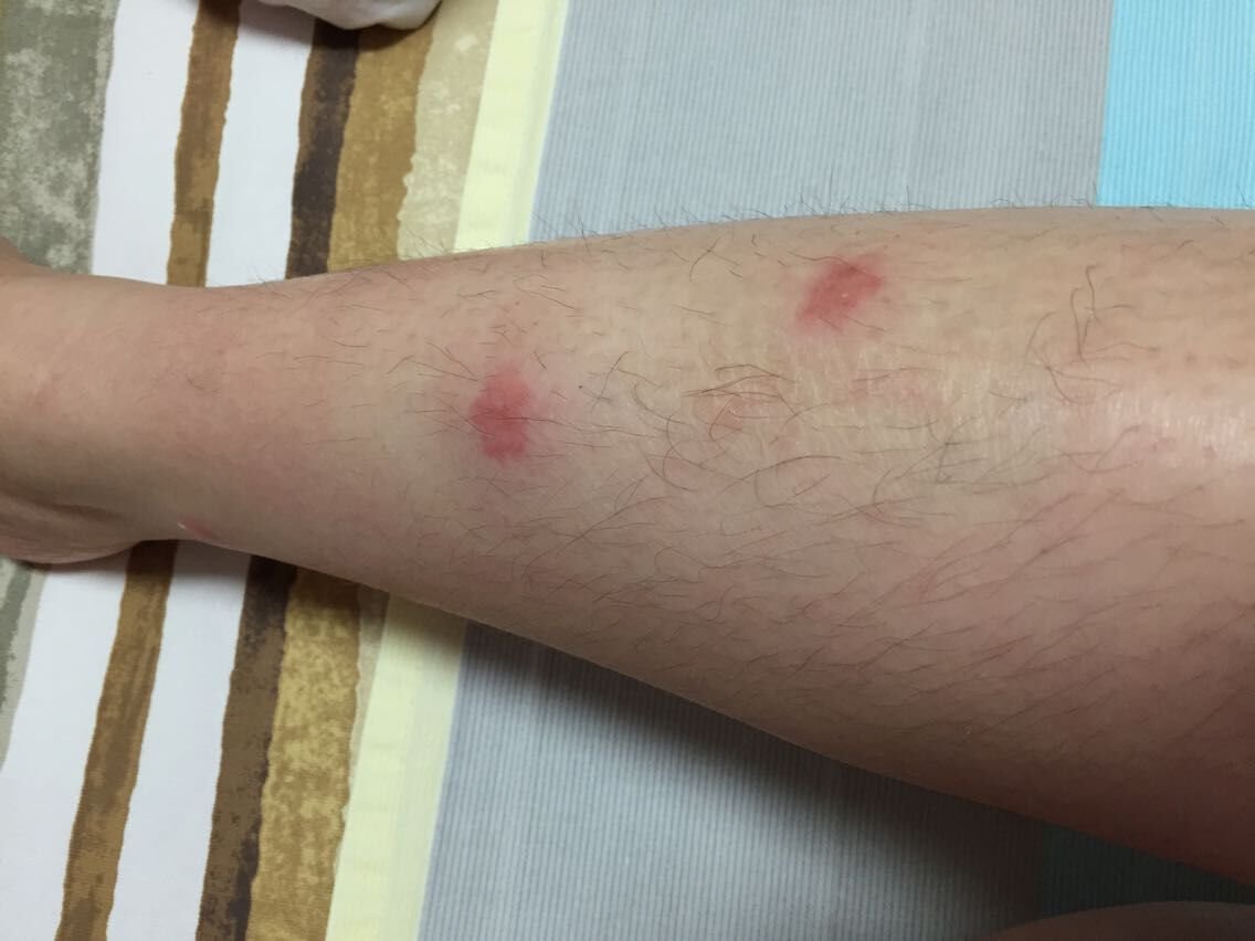 北京一小区跳蚤泛滥，这是什么原因造成的？