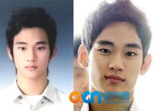 金秀贤整容了吗