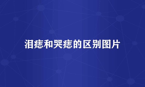泪痣和哭痣的区别图片