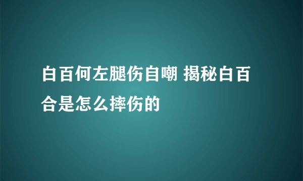 白百何左腿伤自嘲 揭秘白百合是怎么摔伤的