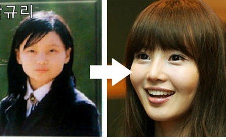 南圭丽真的整容过???