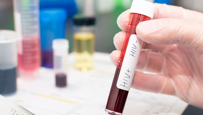 成都一小区出现100元高价民间核酸检测，这样的收费是否合理？