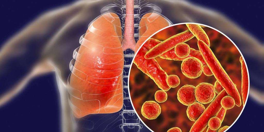 新冠肺炎已成美国第二大致死原因,第一致死原因是什么?