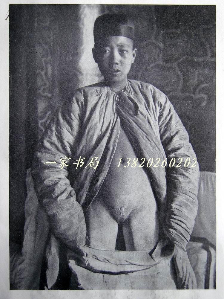 太监是没了什么