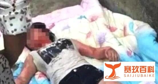 少女遭开水灌嘴 如此残忍暴行是种人性伦桑引共怒