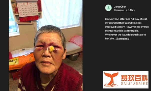 美国华裔阿婆英勇反击扑街仔后全家发声:$90万善款全部捐出!