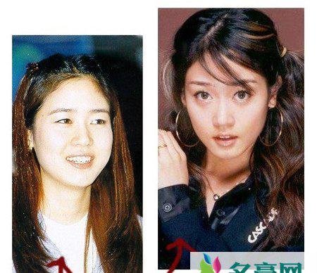 成宥利整容了吗 成宥利整容前后照片