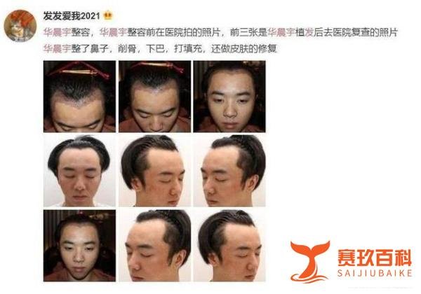 被曝整容出轨?华晨宇回应 这是咋情况？