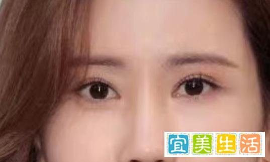 李多海：过度整容成最可惜的韩星！