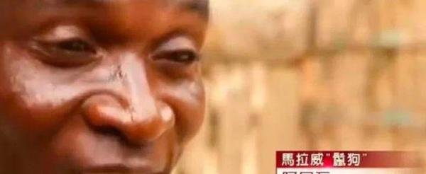 非洲寡妇的噩梦,丈夫去世要和陌生男人性交之后才能祛除邪灵?
