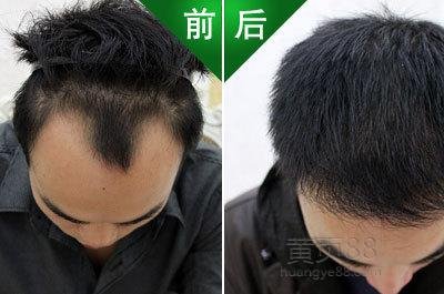 中国白发脱发网的介绍
