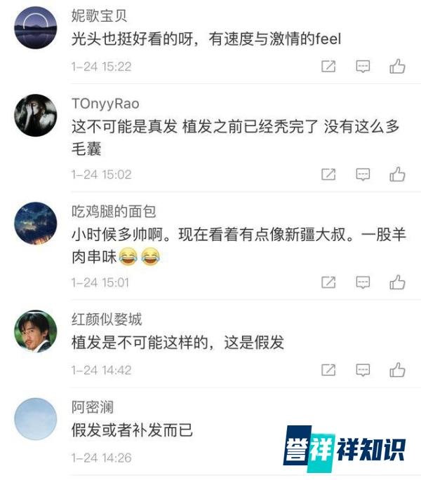 阿尔法植发还是戴假发,网友的评论绝了?