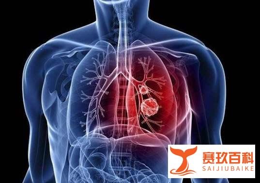 突发！演员李铁因胃出血去世，身体出现这些问题要警惕，关键时刻能救命！