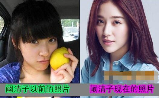 阚清子整过容吗
