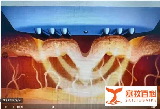 李佳琦推荐的初普美容仪真的好用吗？是智商税还是抗老神器？