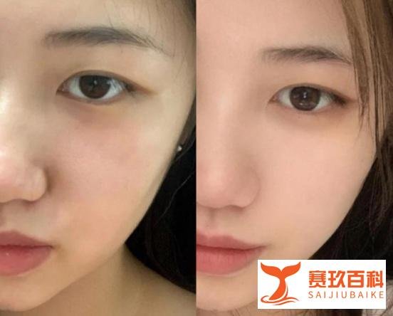 李佳琦推荐的初普美容仪真的好用吗?是智商税还是抗老神器?