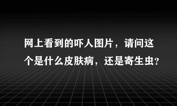 网上看到的吓人图片，请问这个是什么皮肤病，还是寄生虫？