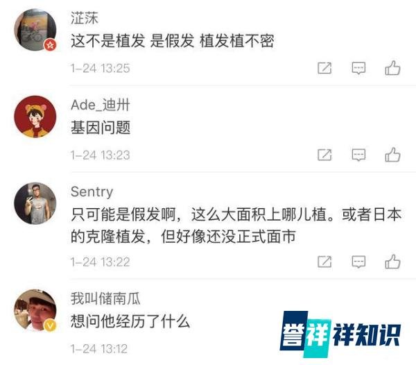阿尔法植发还是戴假发,网友的评论绝了?