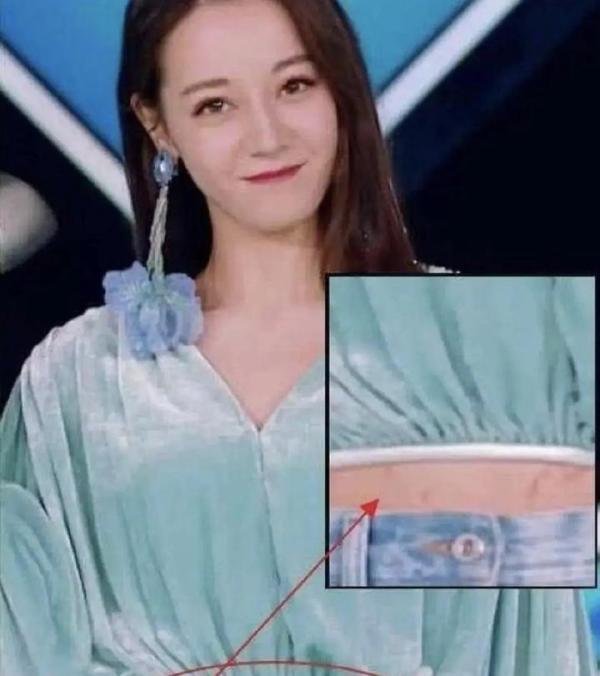 迪丽热巴肚子上有妊娠纹？也有说是肥胖纹，其实都不对，那是伤疤