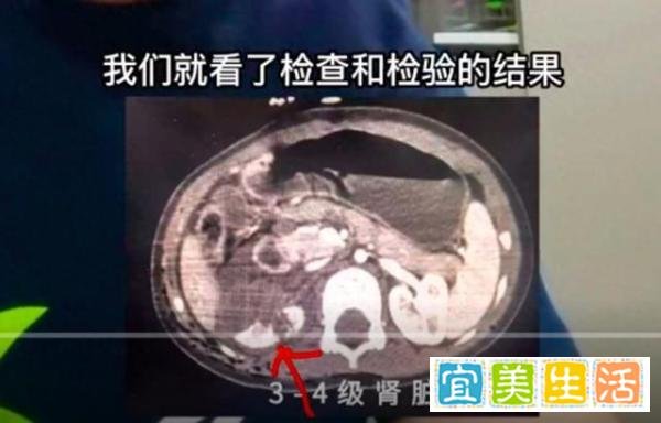 狗咬人主人是否涉嫌犯罪?罗翔解答:狗主人疏于管理属于过失,致他人重伤最高可判刑3年