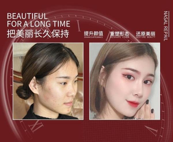 680元双眼皮！880元隆鼻！重庆整形为什么这么便宜？是套路还是真福利？