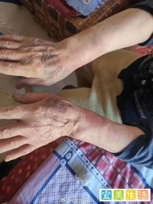 丹东市九十三岁老人在社区开看病通行证 自己受到侮辱后上吊自尽