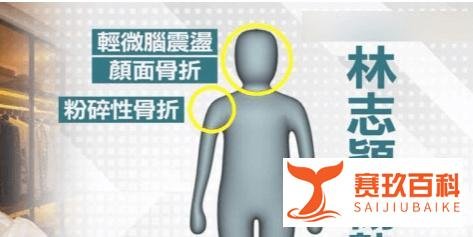 台媒曝林志颖疑似颅内出血