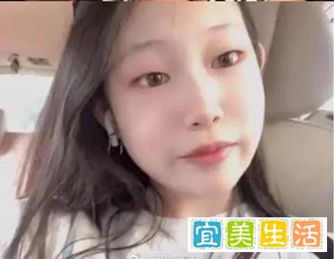 小沈阳13岁女儿晒照，穿露脐装秀好身材，最丑星二代完美逆袭