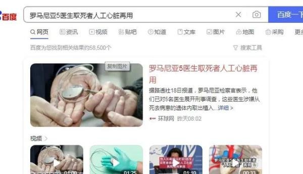 医院疑植错胚胎 安徽卫健委:正调查与罗马尼亚5医生取死者人工心脏再用