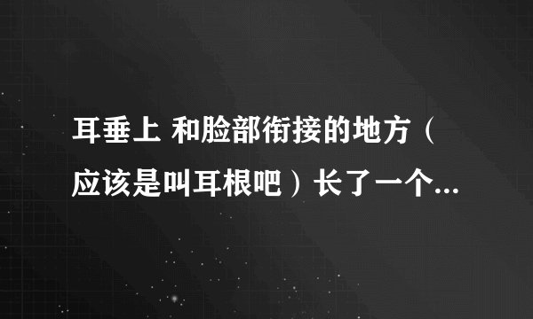 耳垂上 和脸部衔接的地方（应该是叫耳根吧）长了一个小包 跟脸上长的痘痘相似的包 ，不碰不疼。