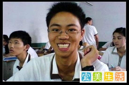 初代网红系列之三十七：龅牙哥